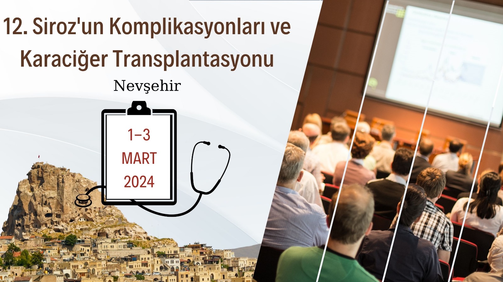 12.Siroz'un Komplikasyonları ve Karaciğer Transplantasyonu
