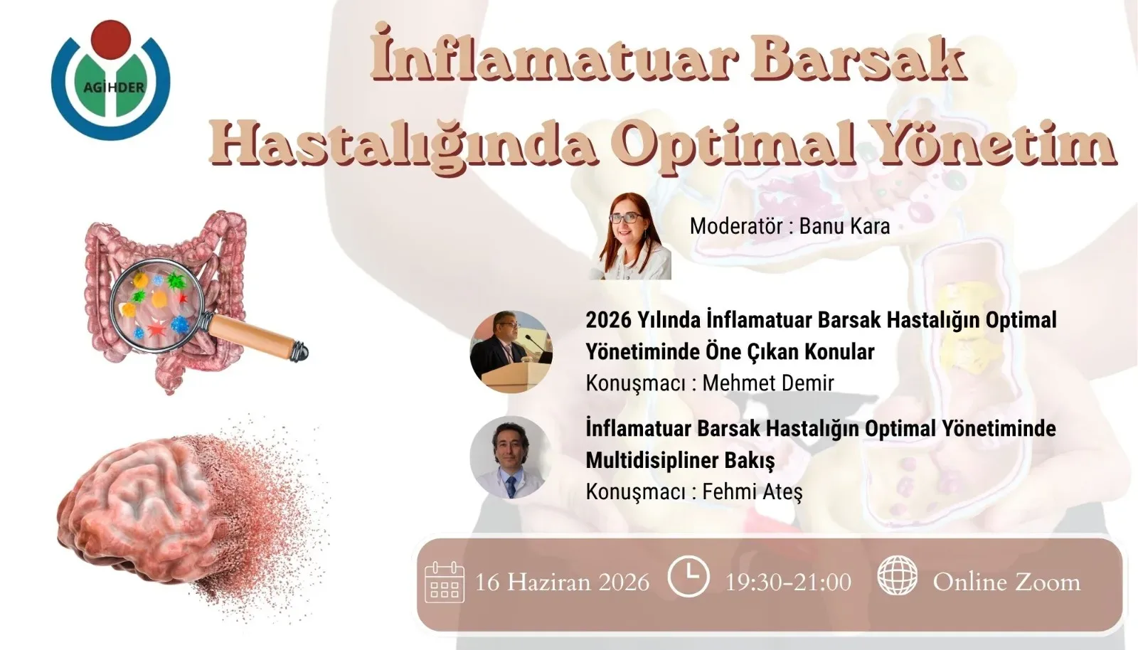 İnflamatuar Barsak Hastalığında Optimal Yönetim