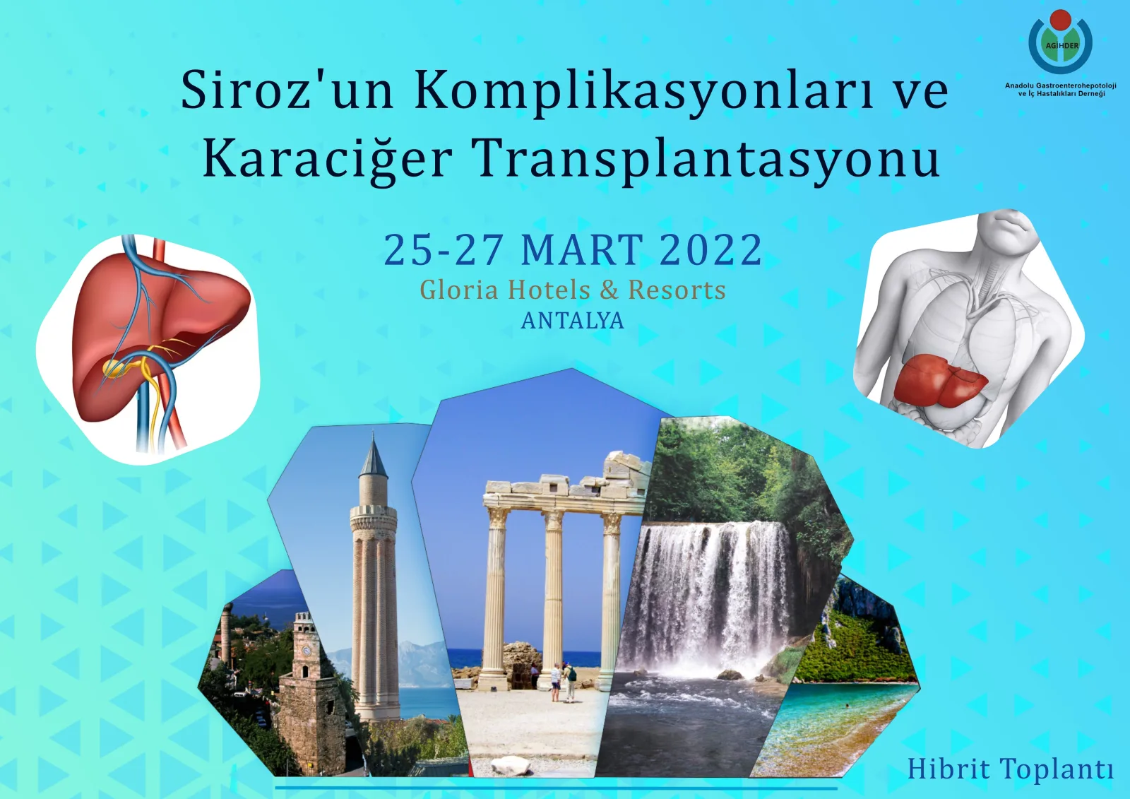 Siroz'un Komplikasyonları ve Karaciğer Transplantasyonu